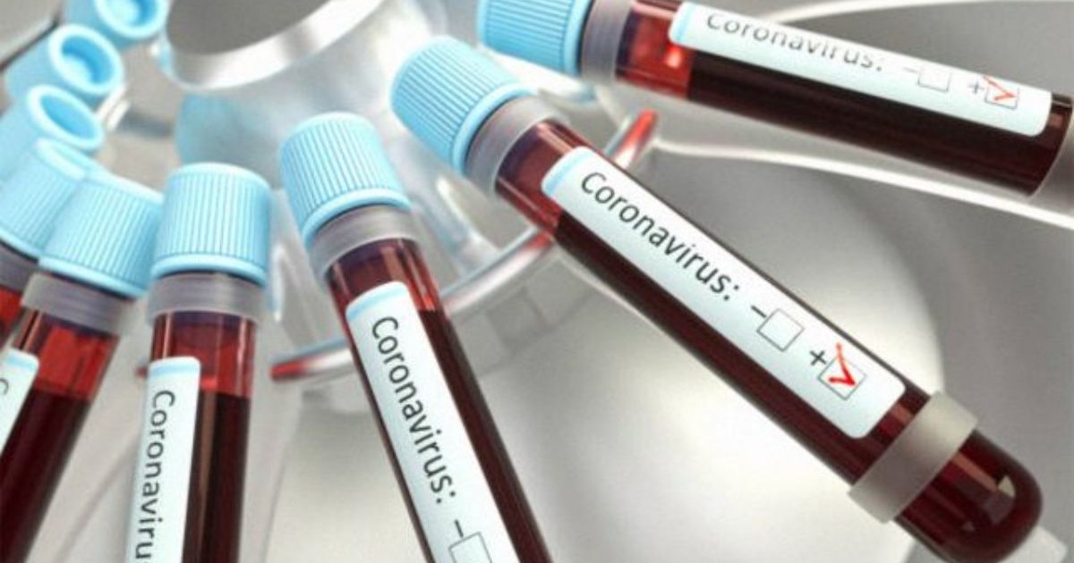 Un estudio vincula la sangre tipo A a los casos más graves de COVID-19
