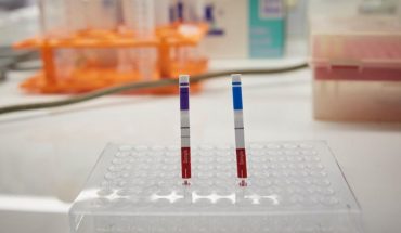 translated from Spanish: Two national universities developed a coronavirus test four times faster than PCR