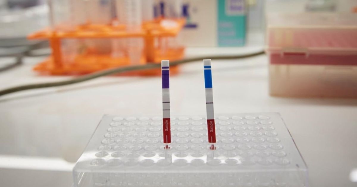 Two national universities developed a coronavirus test four times faster than PCR