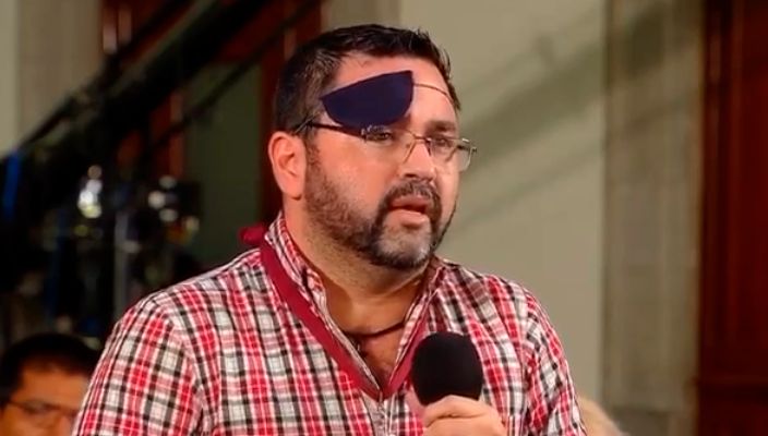 Journalist of the morning forgets his patch and leaves his eye exposed (Video)