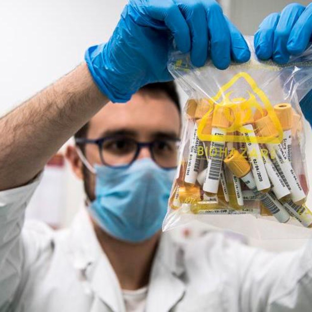 Italia comenzó la primera fase de ensayos de su vacuna para el Covid-19 en humanos