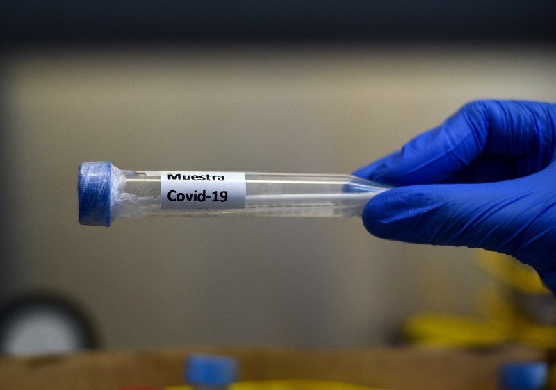 La pandemia de coronavirus supera los 21 millones de contagios en todo el mundo