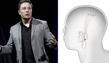 Neuralink, la empresa de Elon Musk, prepara un chip para el cerebro
