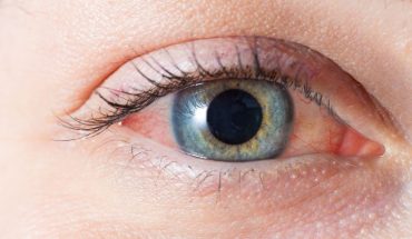 ¿Es bueno suspender el uso de cremas y maquillaje cuando la alergia estacional afecta los ojos?