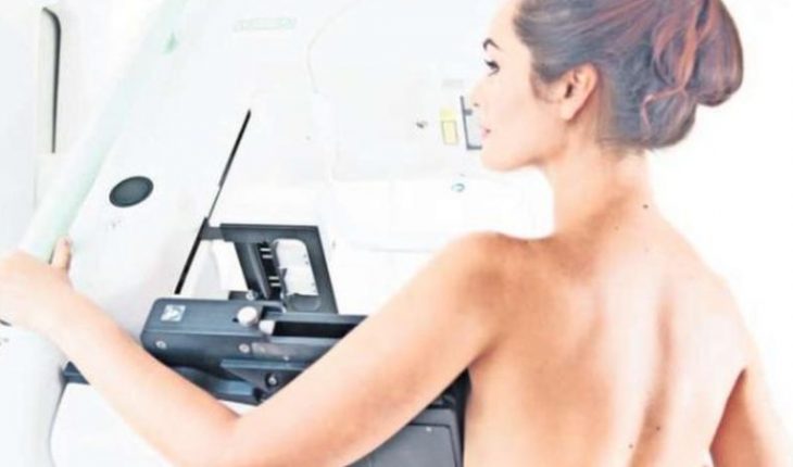 Entre un 70 y un 80% de las mujeres habría dejado de hacerse la mamografía por la pandemia