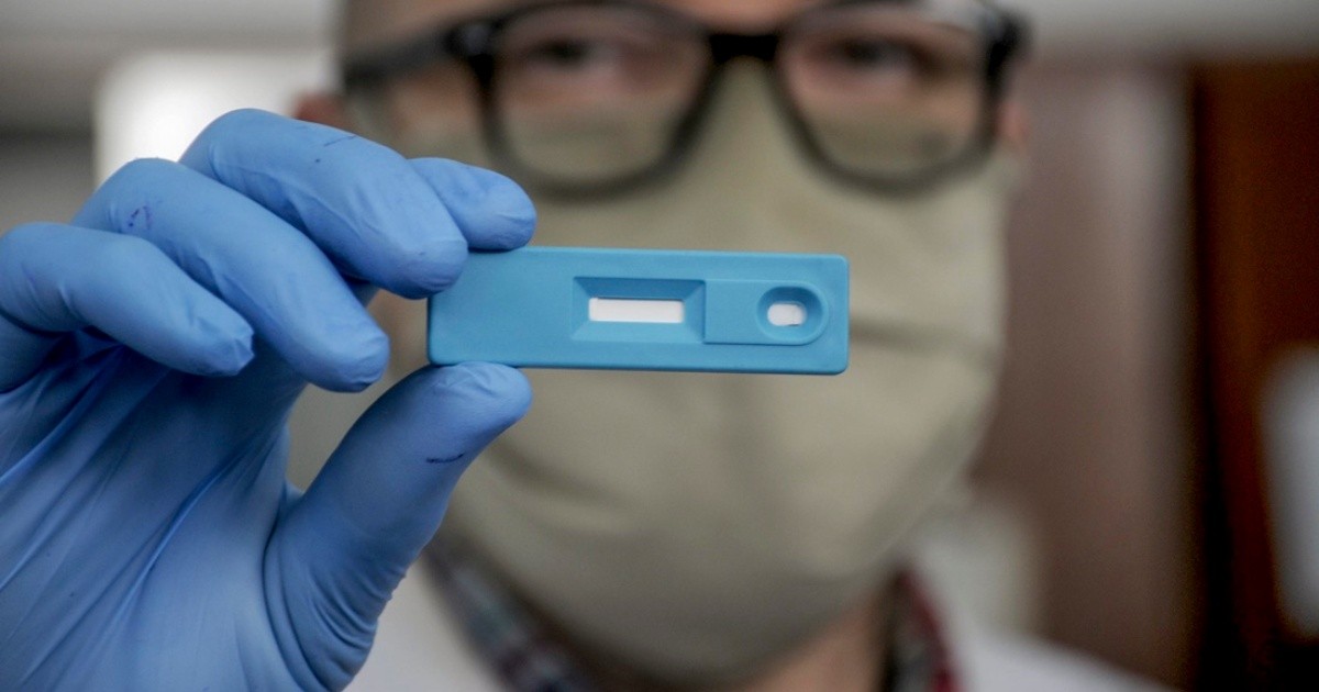 La Plata: crean un test serológico que en 5 minutos detecta el coronavirus