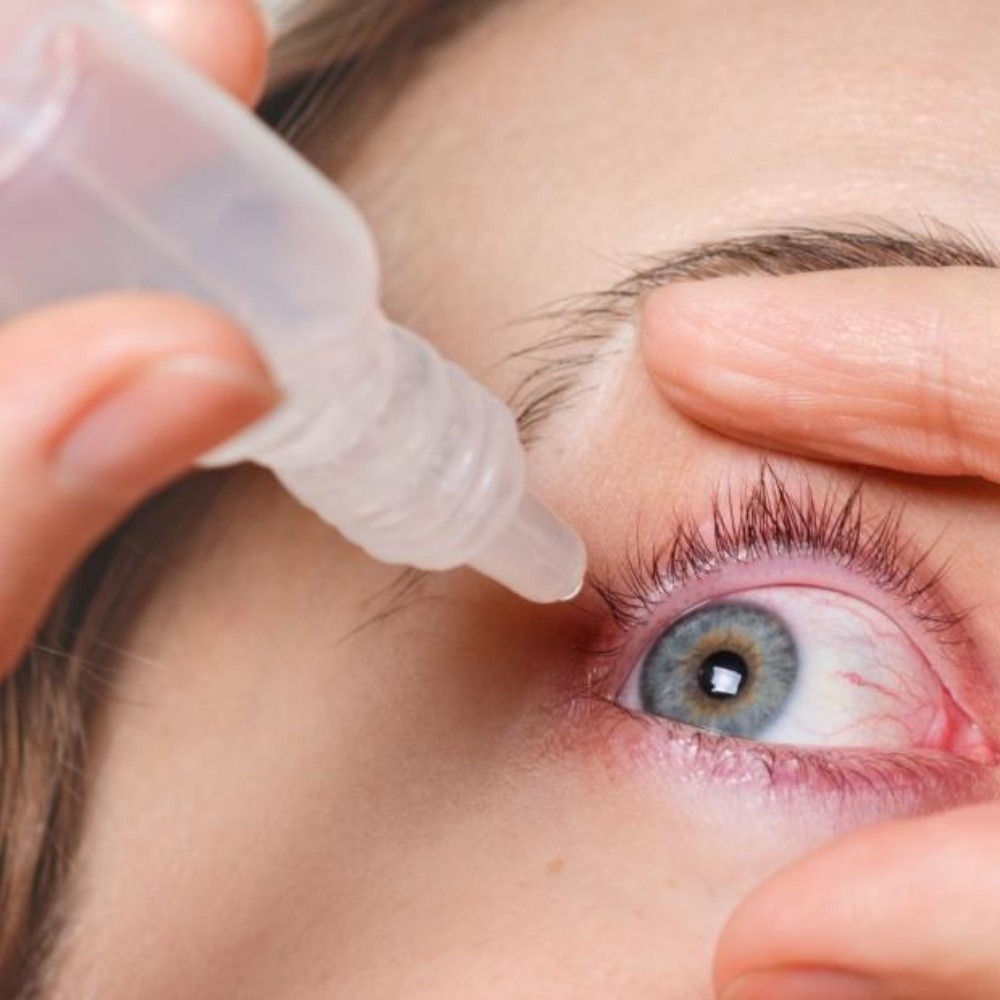 Qué es el síndrome de ojo seco y por que aparece