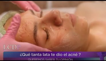 Video: La solución al acné | La Caja de Pandora