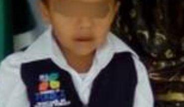 Niño se quema con café hirviendo en Puebla, piden ayuda para tratamiento