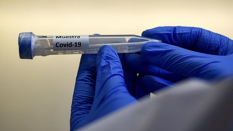 Reportan 144 casos nuevos de Covid-19 en la región de Coquimbo