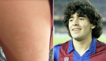 More alive than ever: A young man saw the image of Diego Maradona on one leg?
