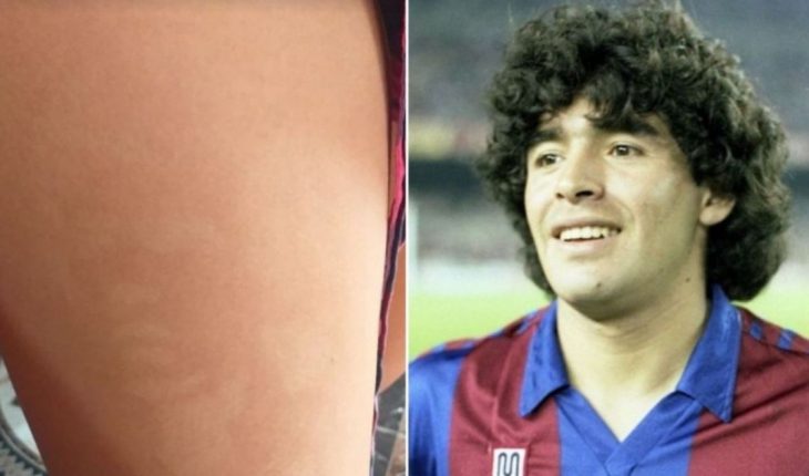 translated from Spanish: More alive than ever: A young man saw the image of Diego Maradona on one leg?