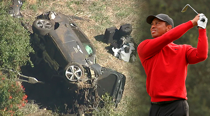 Tiger Woods had rods and screws placed on his legs