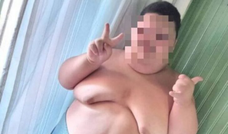 Piden ayuda para niño de diez años que pesa 200 kilos en Brasil