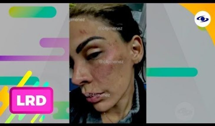 Video: La Red: modelo y cantante revela haber sido víctima de maltrato por parte de Eleacer Gómez