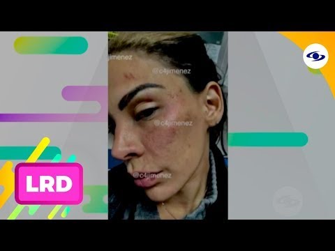 La Red: modelo y cantante revela haber sido víctima de maltrato por parte de Eleacer Gómez