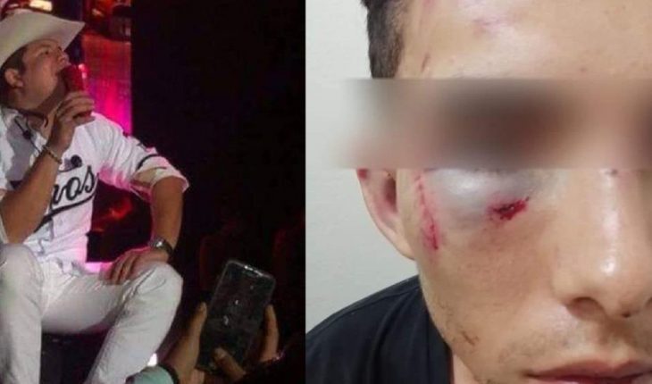 Primo de Remmy Valenzuela lo demanda por violencia y lesiones