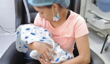 translated from Spanish: Baby is born in Colombia without palate, lip and part of the nose