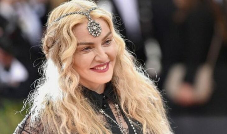 Madonna preocupa a fanáticos con foto en Instagram de enorme moretón