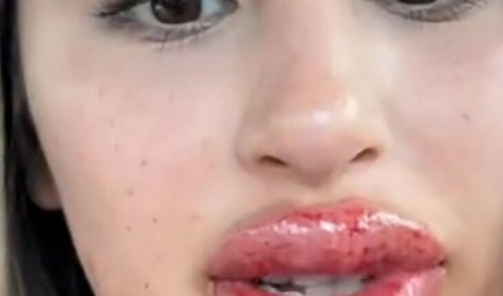 Mujer termina con los labios hinchados tras un tatuaje