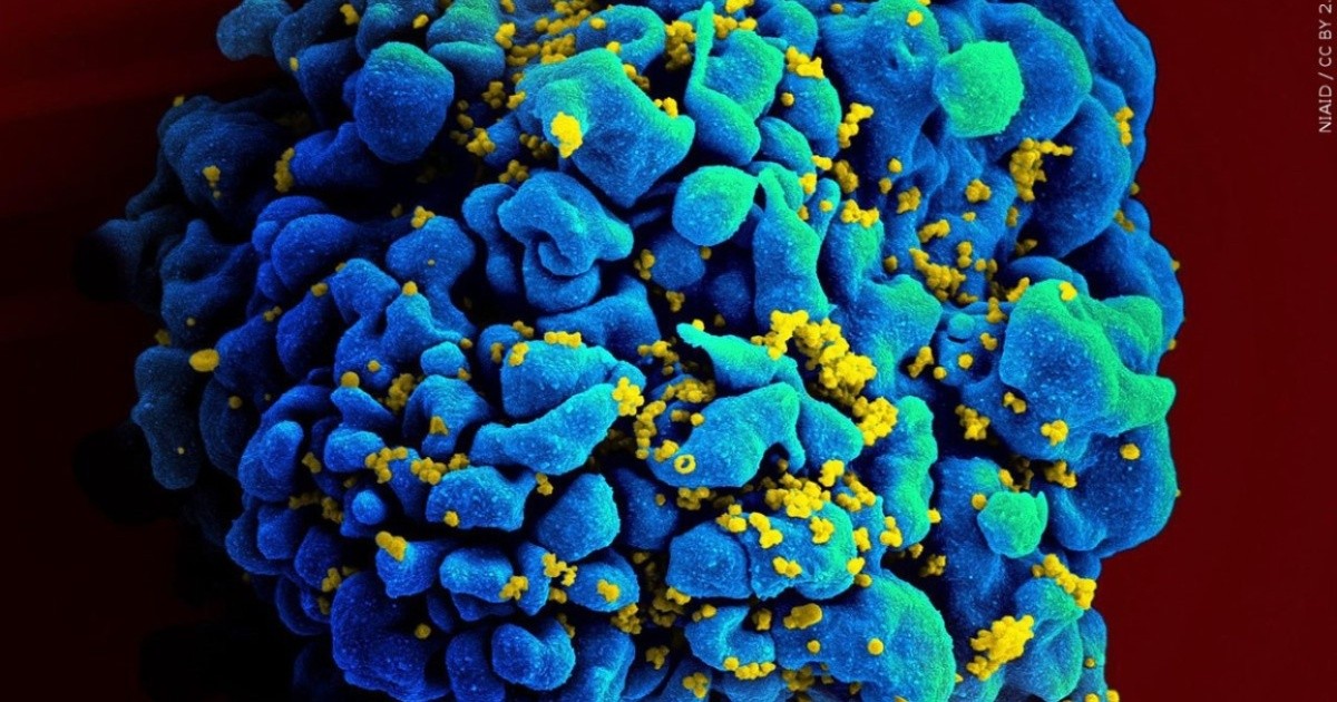 Scientists Document Third Known Case of HIV Remission