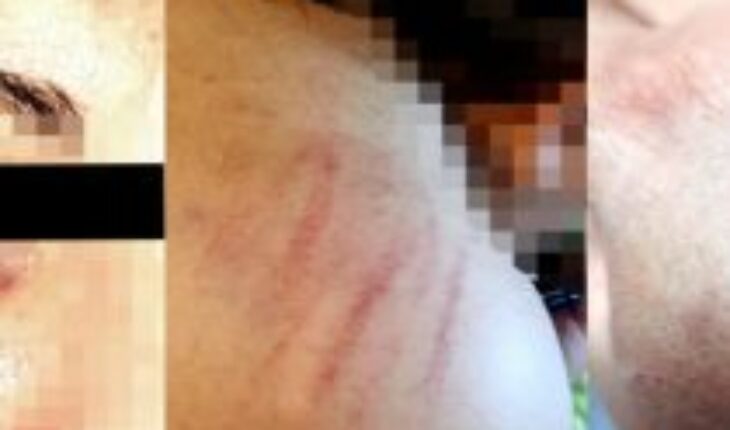 “Mariconas tortilleras”: pareja es golpeada por vecinos dos veces en un ataque por lesbofobia