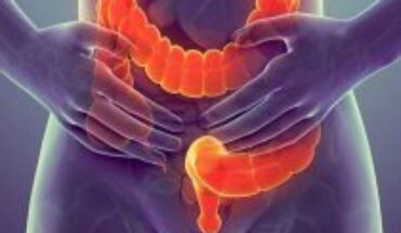 Stress, sedentary lifestyle and poor diet: three factors that affect irritable bowel