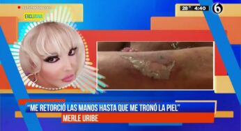 Video: Merle Uribe indignada por ataque de vecina | El Chismorreo