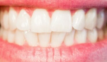 Vitamins and nutrients for healthy gums and teeth