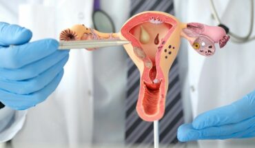 El asesoramiento genético, clave para la detección temprana del cáncer de ovario