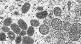 Israel reported first case of monkeypox and concern grows