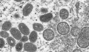 Israel reported first case of monkeypox and concern grows