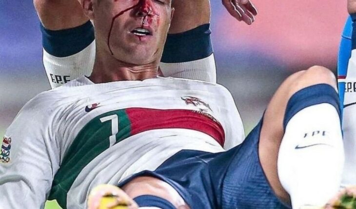 Cristiano Ronaldo received a violent blow to the face and raised concerns