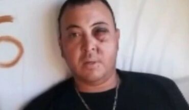 “Me arruinaron la vida”: un hincha de Gimnasia podría perder un ojo por un balazo