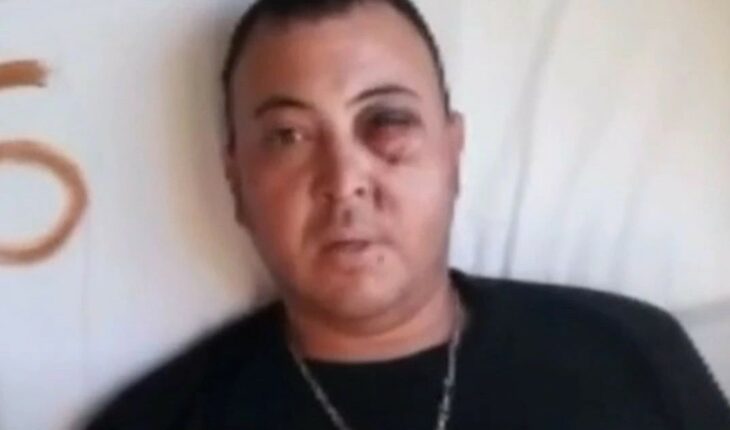 “Me arruinaron la vida”: un hincha de Gimnasia podría perder un ojo por un balazo