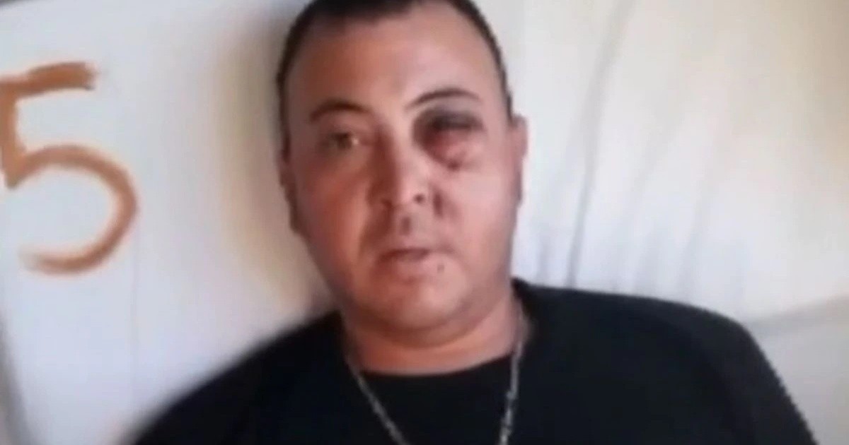 "Me arruinaron la vida": un hincha de Gimnasia podría perder un ojo por un balazo