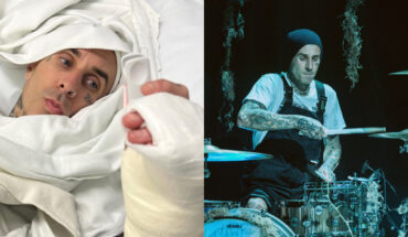Travis Barker de Blink-182 sube impactante foto de su operación — Rock&Pop