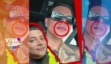Video: Eduin Caz sorprende con arreglitos en el rostro | Vivalavi