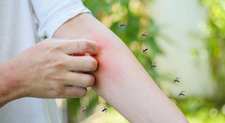Conoce los síntomas del dengue para pedir atención médica inmediata: SSM – MonitorExpresso.com