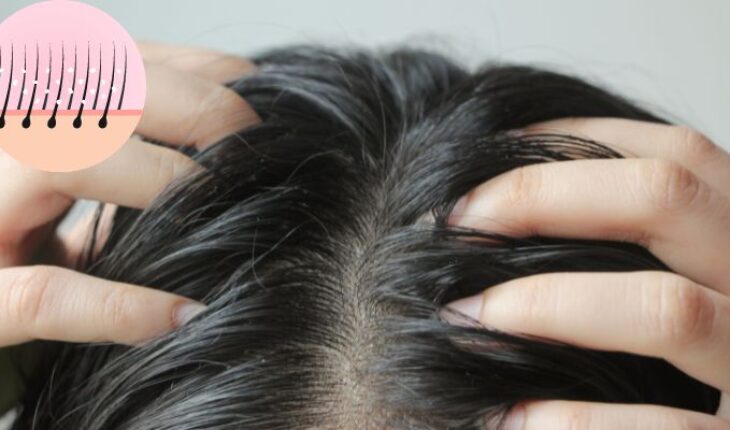 La protección solar para el cuero cabelludo es clave para prevenir daños y el cáncer de piel – MonitorExpresso.com